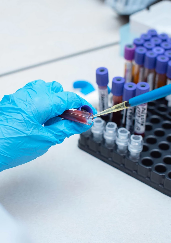 prenatal-testing