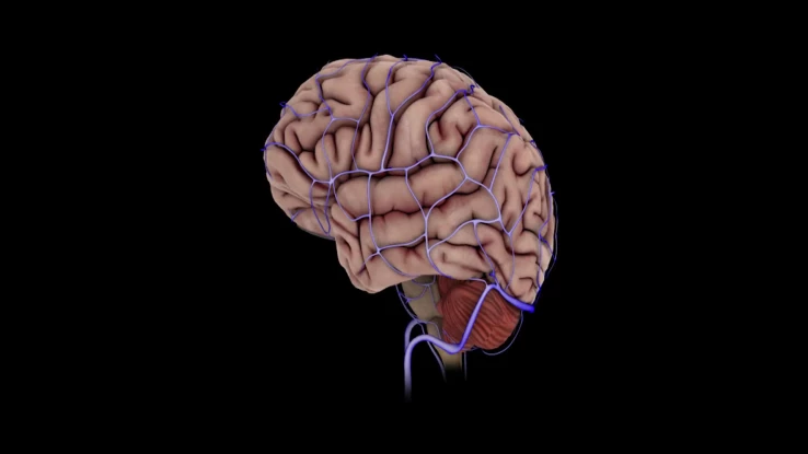 5_Thrombus_thumbnail